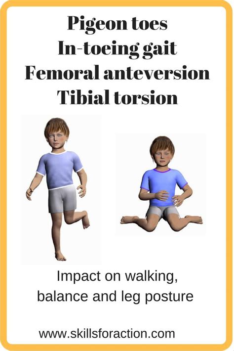 femoral anteversion pediatrics